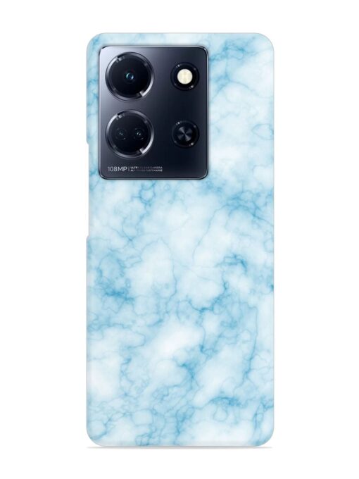 Blue White Natural Marble Snap Case for Infinix Note 30 (5G) Zapvi